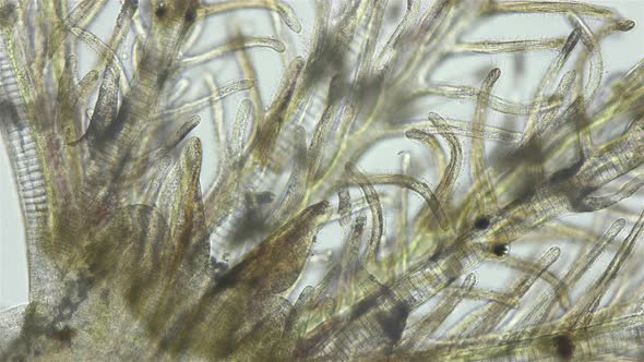 Polychaeta Worm Family Sabellidae Under a Microscope alt