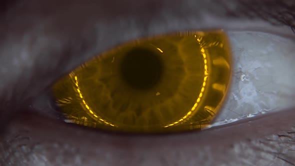 Blinking Eye With An Iris Of Yellow Colors With Ring Light In Closeup