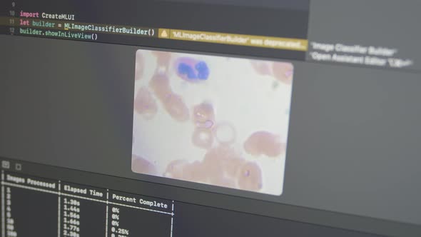 Blood Cells Microscopy Training Deep Learning Neural Network Model alt