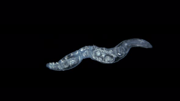 worm Nais sp. under a microscope, Family Naididae, a class of Oligochaeta alt