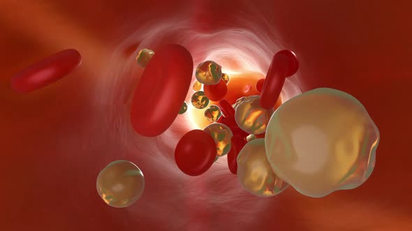 3D animation of clogged and tightened rtery with cholesterol cells alt