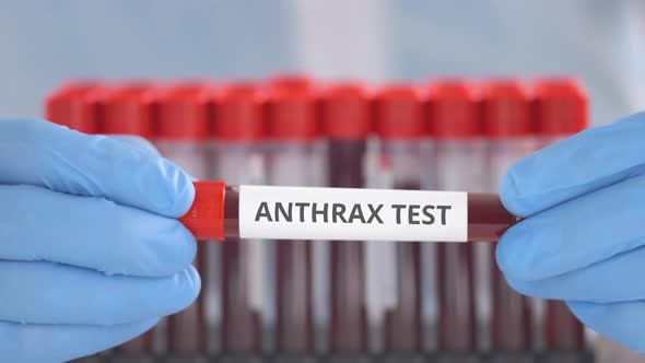 Laboratory Assistant Holds Vial with Anthrax Test alt