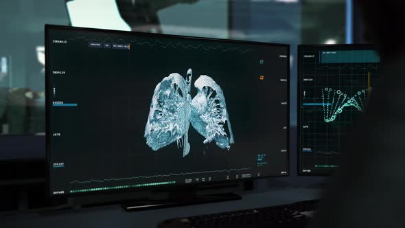 Analyzing the effects of Covid-19 Pneumonia on human lungs with a CT scan. UI alt