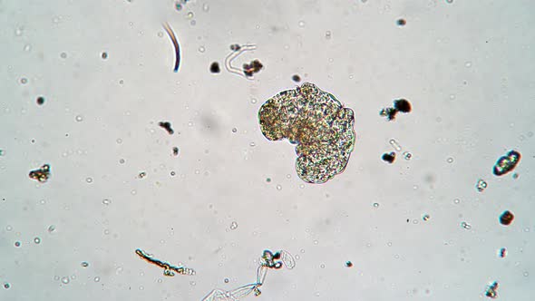 Small Moss Piglet is Walking Through Algea and Different Bacteries in Magnification alt