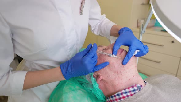 Midle Aged Man Getting Biorevitalization Lifting Procedure in Cosmetology Clinic alt