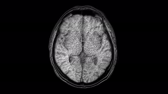 Voluminous MRI Scans of the Brain and Head To Detect Tumors. Diagnostic Medical Tool alt