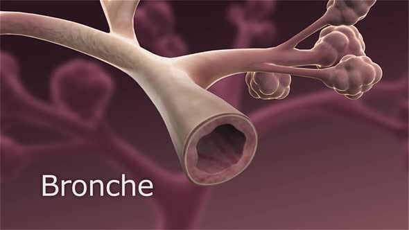 obstruction of the bronchi alt