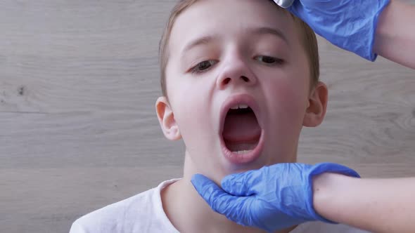 Doctor ENT Pediatrician in Latex Nitrile Gloves Examines Oral Cavity of a Boy alt