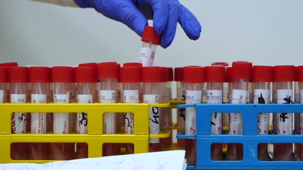 Test Tubes with Vaccine in Lab Hand Takes Test Tube Pkr Test alt