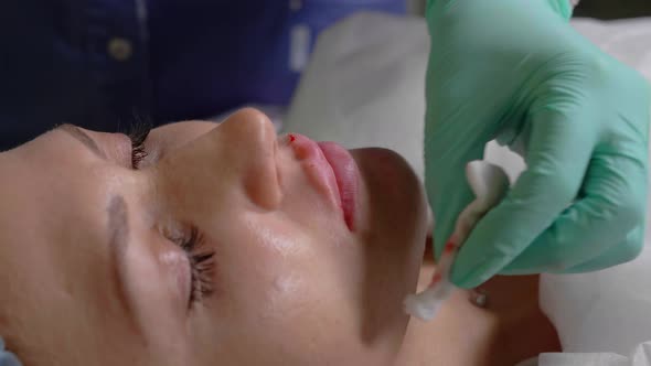 Injection To Increase the Lips in a Cosmetic Clinic
