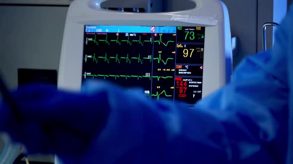 Cardiac Monitor During Surgery in Operating Room