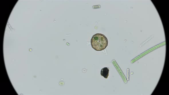 Testate Amoeba Arcella alt