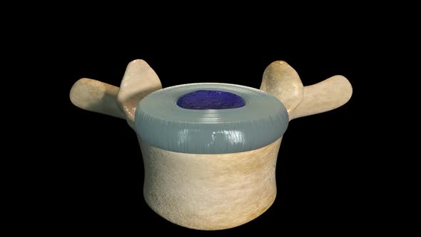 Overview Of Intervertebral Disc Mechanics alt