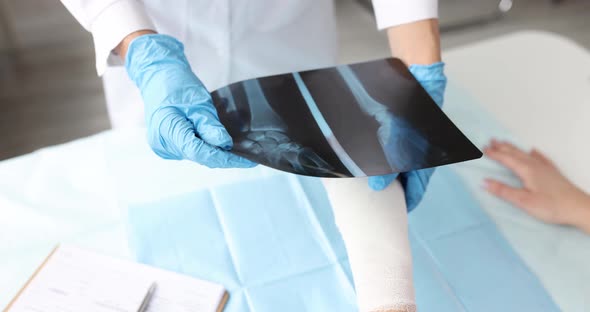 Doctor Holds Bandaged Hand and Xray of Patient alt