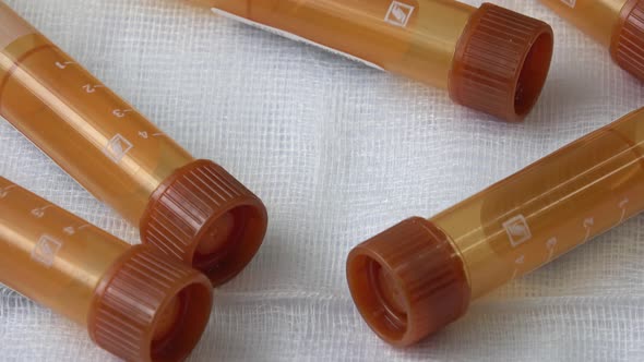 Plastic test tubes with brown caps for the collection of samples. Medical modern medicine