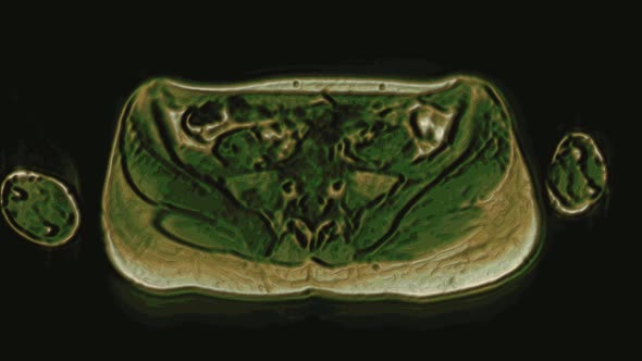 Bulk Multicolored MRI of the Female Pelvic Organs, Abdominal Cavity, Gastrointestinal Tract and alt