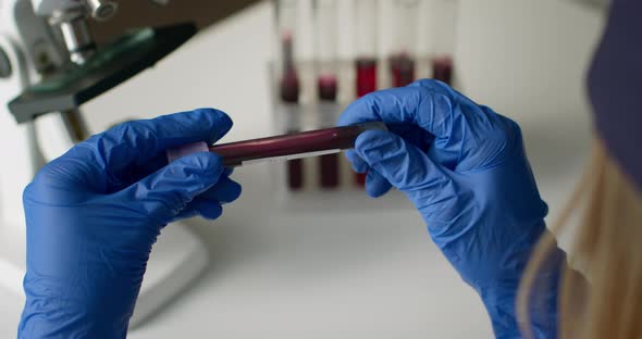 Close-up Shot. The Doctor Is Holding a Test Tube with a "Positive" Test for COVID-19. Experiments in alt