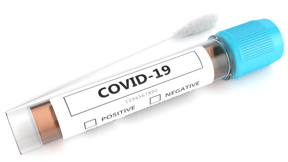 Covid-19 nasal swab laboratory test