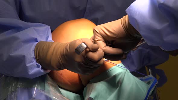 Knee Surgery or Anterior Cruciate Ligament Reconstruction 7