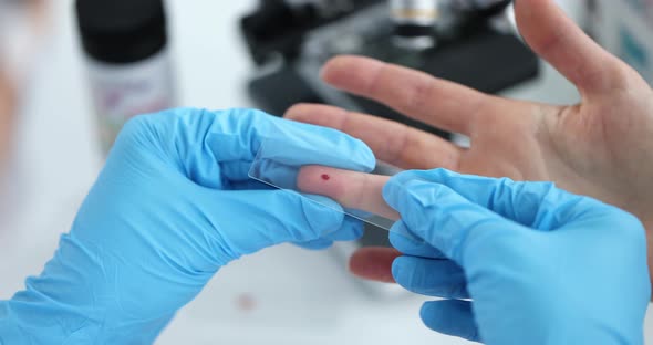 Doctor Takes Blood Test on Glass in Laboratory Closeup alt