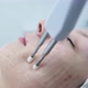 Cosmetic Procedure to Improve the Condition of the Skin of the Face with Microcurrents - VideoHive Item for Sale