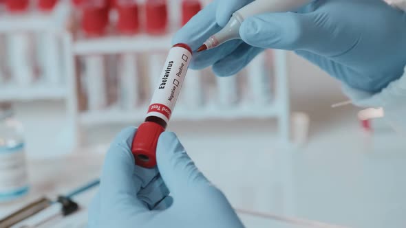 The Doctor Holds Hand Laboratory Positive Blood Test Tube for Virus Ebola alt