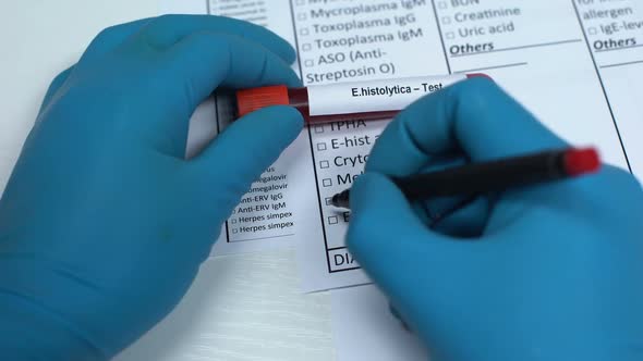 E Histolytica, Doctor Checking Name in Lab Blank, Showing Blood Sample in Tube alt
