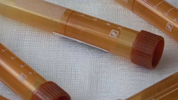 Plastic test tubes with caps for the collection of samples. Medical modern medicine