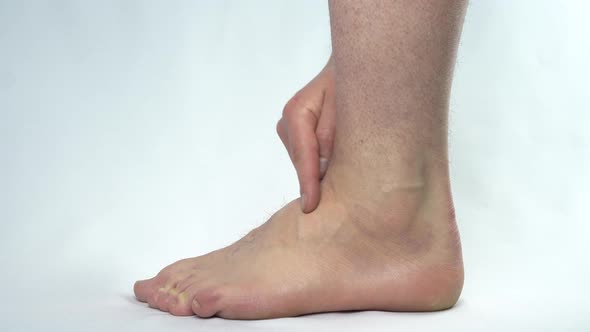 A Man Touches a Leg on Which a Hygroma alt