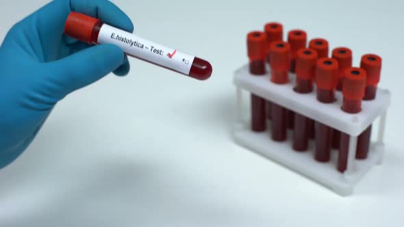 Negative E Histolytica Test, Doctor Showing Blood Sample Lab Research Healthcare alt