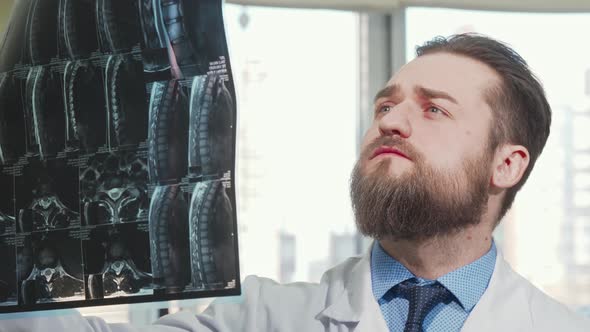 Bearded Male Doctor Examining Mri Scan of His Patient alt