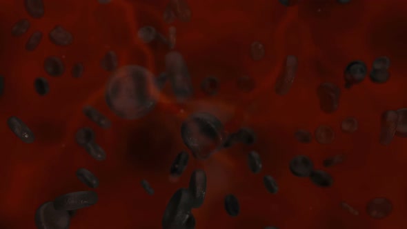 Sick Blood Cells Traveling In The Human Body alt