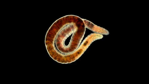 Worm of the Lumbriculidae Family Under a Microscope, Class Clitellata, Oligochaeta Specimen Found  alt