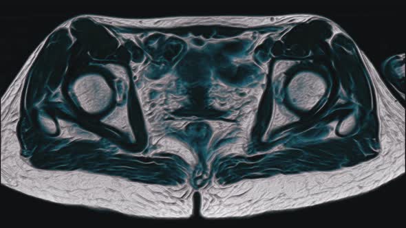 Voluminous Color MRI of the Female Pelvic Organs, Abdominal Cavity, Gastrointestinal Tract and alt
