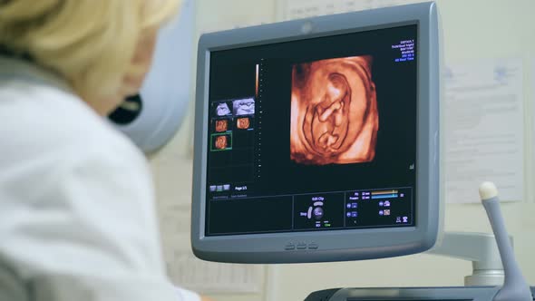 A Doctor Checks a Baby in Womb Using Sonogram alt