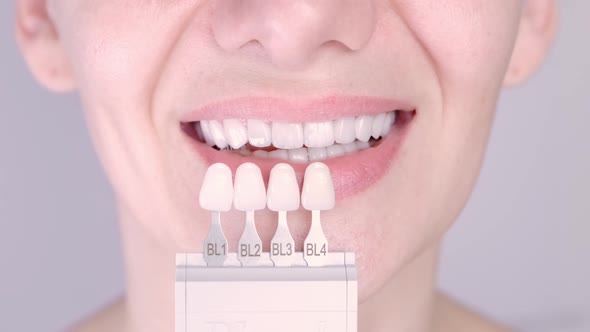 Perfect White Teeth Close Up with Shade Guide Bleach Color Female Veneer Smile Dental Care and alt
