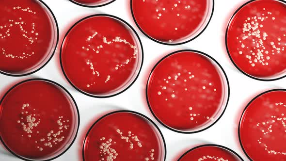 Petri dishes with red blood agar containing colonies of Staphylococcus aureus