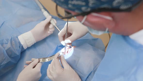 Team of Dental Surgeons Performing Careful Surgical Operation Treatment on Patient