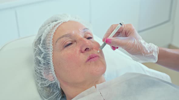 Doctor Marks Facial Zones for Botox Procedure