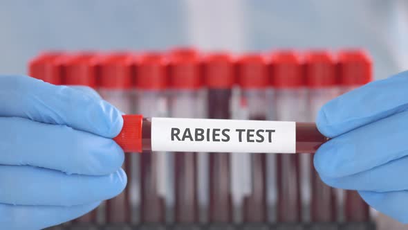 Laboratory Assistant Holds Vial with Rabies Test alt