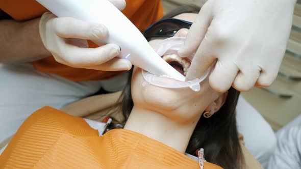Doctor Dentist Makes a 3D Scan of the Teeth of a Female Patient for Treatment alt