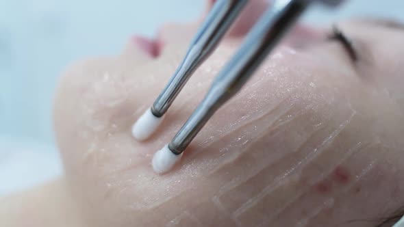 Cosmetic Procedure to Improve the Condition of the Skin of the Face with Microcurrents alt