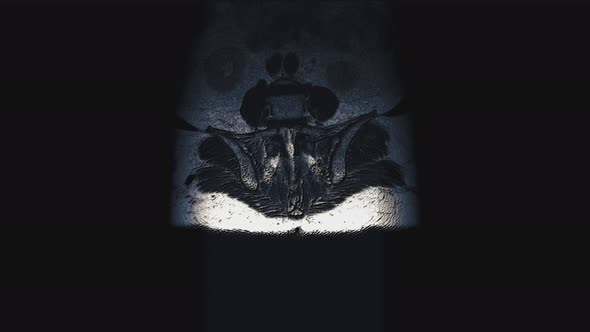 Postoperative Voluminous Color MRI of Female Organs for the Detection of Metastases alt