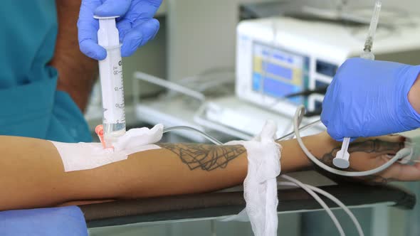 Close-up, Peripheral Venous Catheter Is Installed on Patient's Arm. Doctor or Nurse, in Medical alt