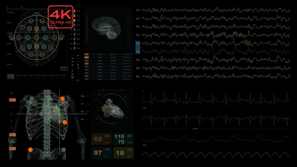 Medical screen. ECG. EEG. 4K