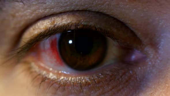 Bloody Human Eye alt