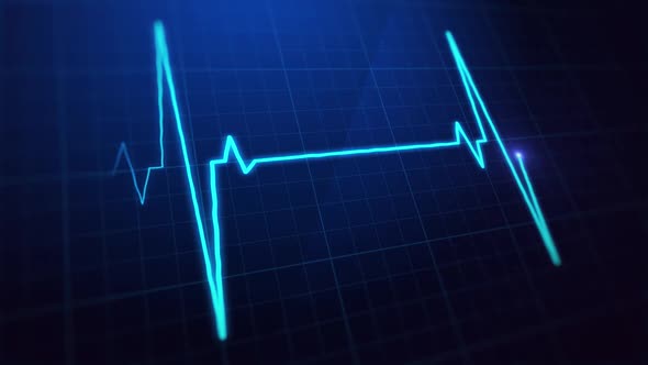 Digital EKG Pulse Screen