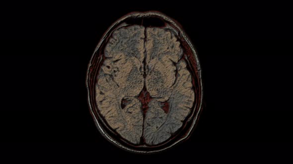 Bulk Multicolored MRI Scans of the Brain and Head To Detect Tumors. Diagnostic Medical Tool