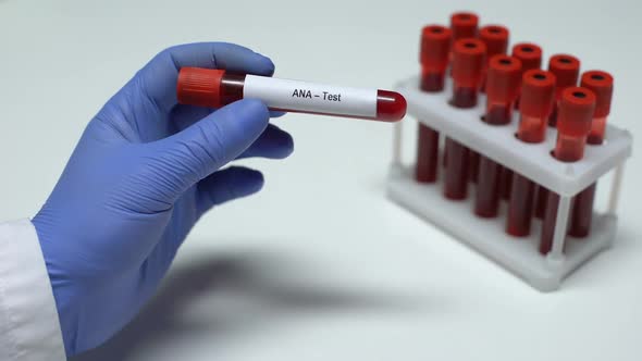 ANA Test, Doctor Showing Blood Sample in Tube, Lab Research, Health Checkup alt