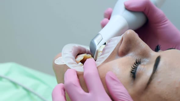 Dentist Scanning Patient's Teeth
